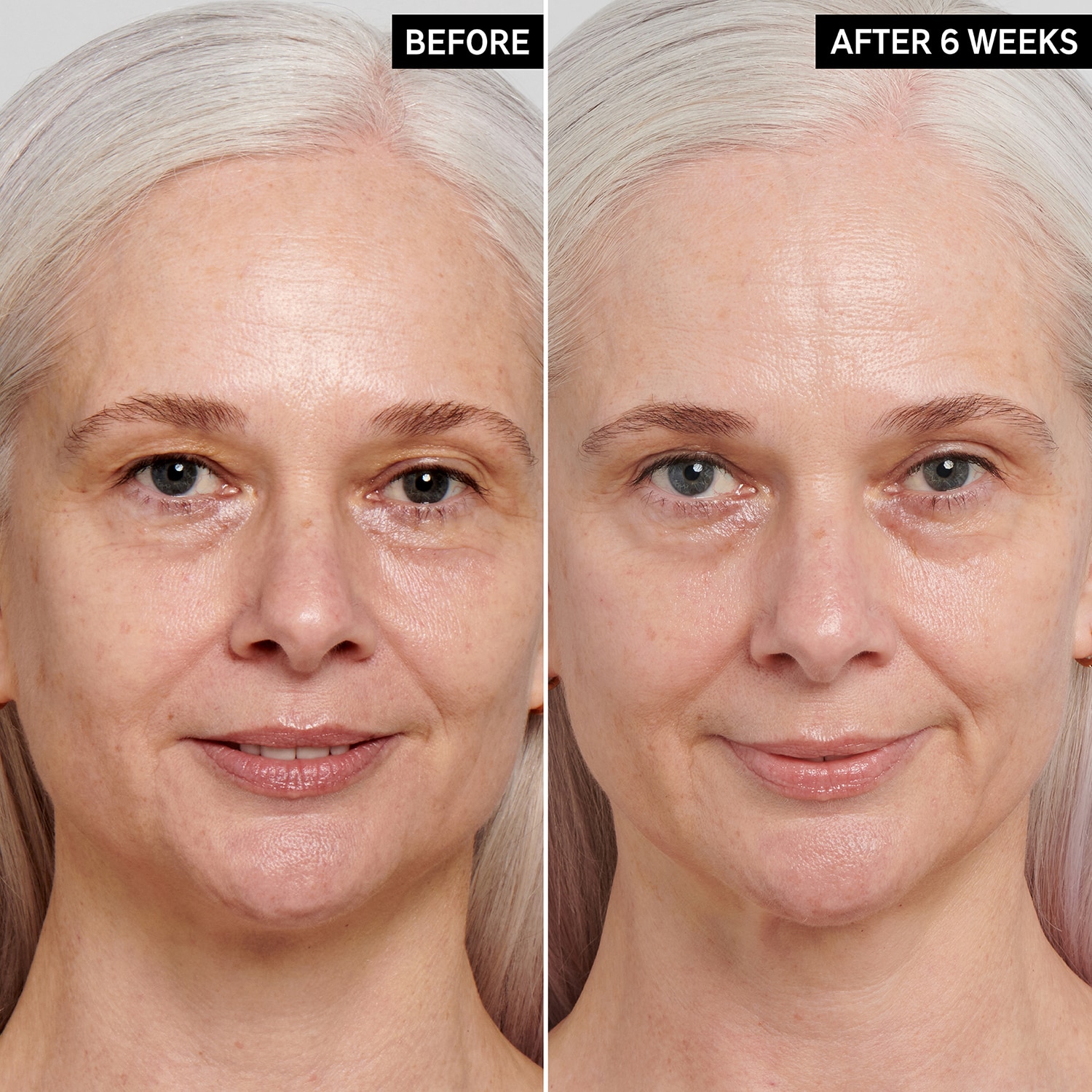 RETINOL ANTI-AGING SERUM (SUERO DE RETINOL)